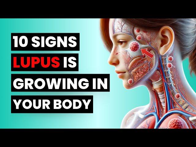 Don't Miss These 10 Early Lupus Signs – It Could Save You!