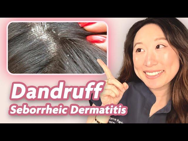 All about Dandruff & Seborrheic Dermatitis | Dermatologist Explains