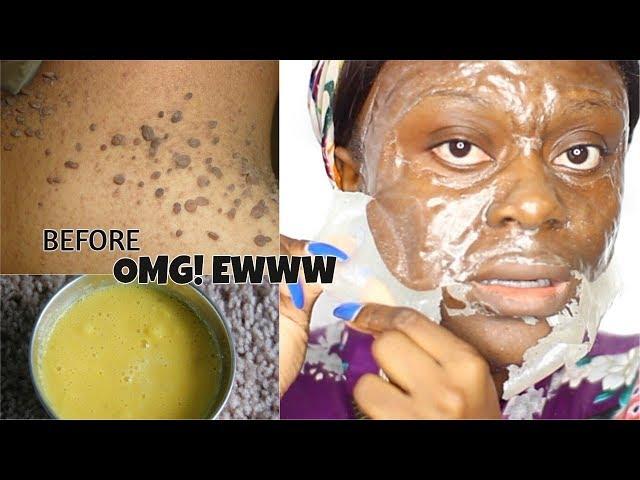 DIY MILK BLACKHEAD PEEL OFF MASK | UNCLUG  BLACKHEADS, WHITEHEADS AND UNWANTED FACIAL HAIR