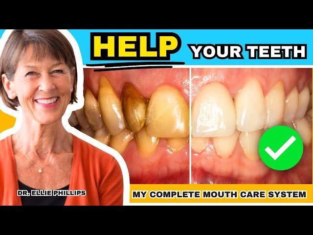 How To Create Healthy Teeth - My Complete Mouth Care System (Step-by-Step)