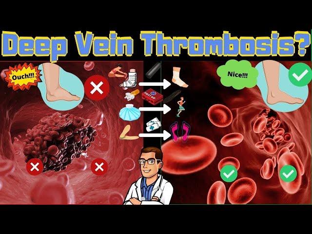 Deep Vein Thrombosis [Blood Clot in Leg or Foot vs. Leg Swelling?]