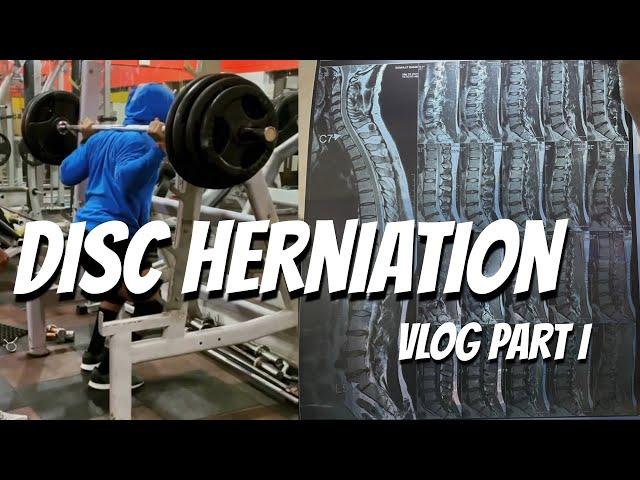 SLIPPED DISC | DISC HERNIATION | HOW AND WHERE IT BEGAN