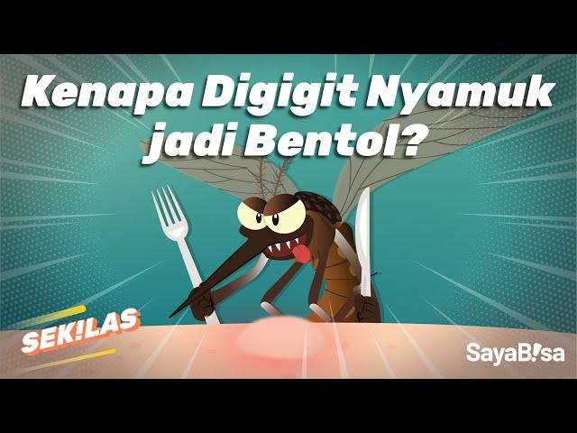 Digigit Nyamuk Bisa Bikin Bentol? | SeKiLas