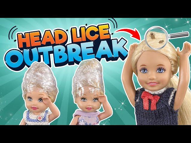 Barbie - The Head Lice Outbreak | Ep.332