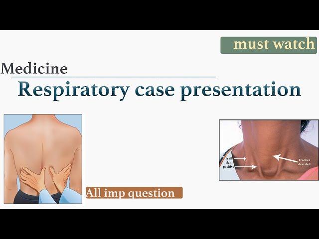 Respiratory case presentation | medicine practical viva