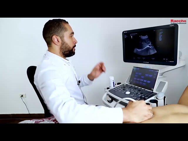 Mindray DC-40 Color Ultrasound Machine with Trolley