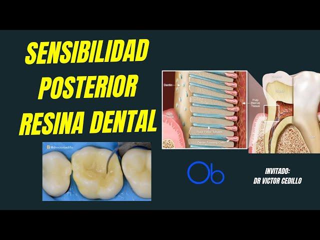 Sensibilidad Posterior a Resina Dental 