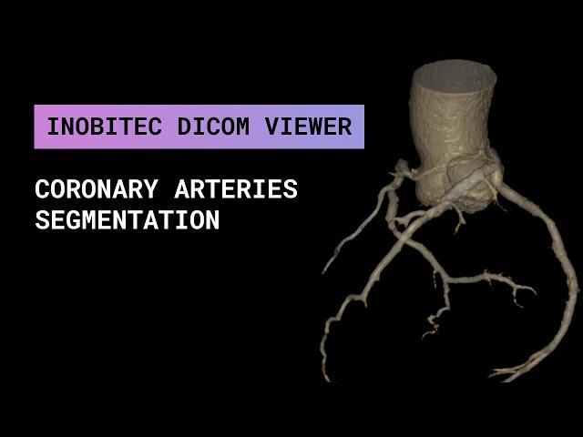 Coronary arteries segmentation in Inobitec DICOM Viewer Pro