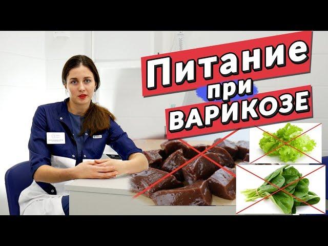 Питание при ВАРИКОЗЕ. Что МОЖНО и НЕЛЬЗЯ есть?