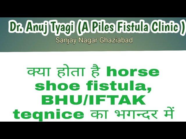 क्या होता horse shoe भगन्दर, इस तरह के fistula में BHU / IFTAK  Teqnice से ईलाज हुआ आसान।.आइये जाने!