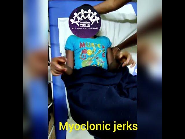 MYOCLONIC JERKS