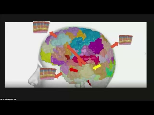 Personalized Brain Mapping