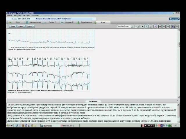 Холтер. Формирование отчета.
