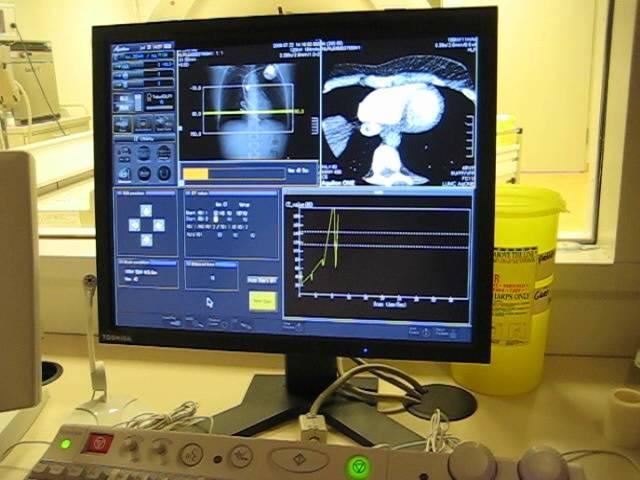 LIVE CT Cardiac on Aquilion ONE