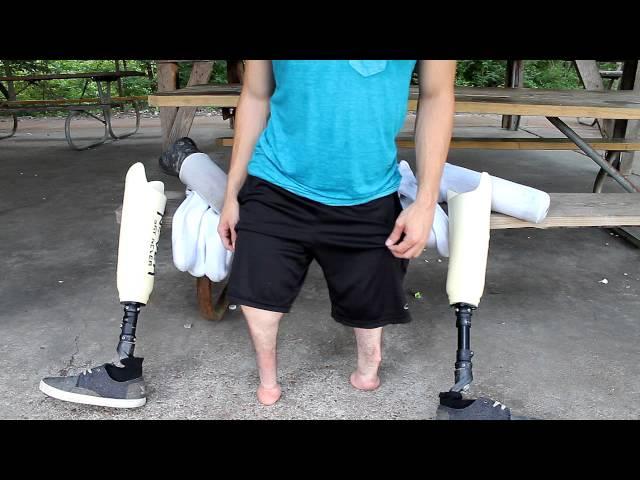 WHY I Can Walk With NO LEGS On My STUMPS!