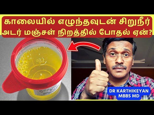 urine infection treatment