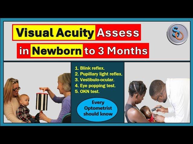 Vision Assessment in Newborn to 3 Months of age.