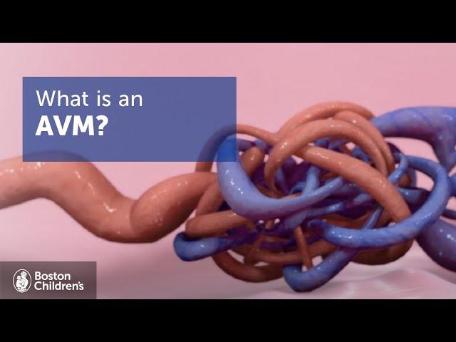 Arteriovenous Malformations (AVMs) | Boston Children's Hospital