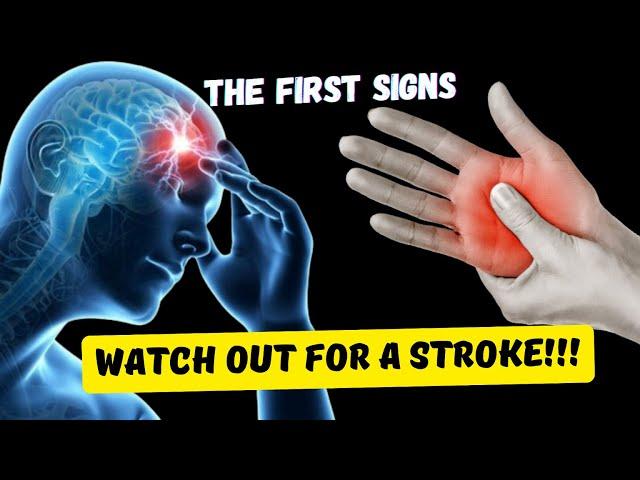 8 Signs of an imminent STROKE! The body warns, DO NOT Miss it - YOU WILL SURVIVE