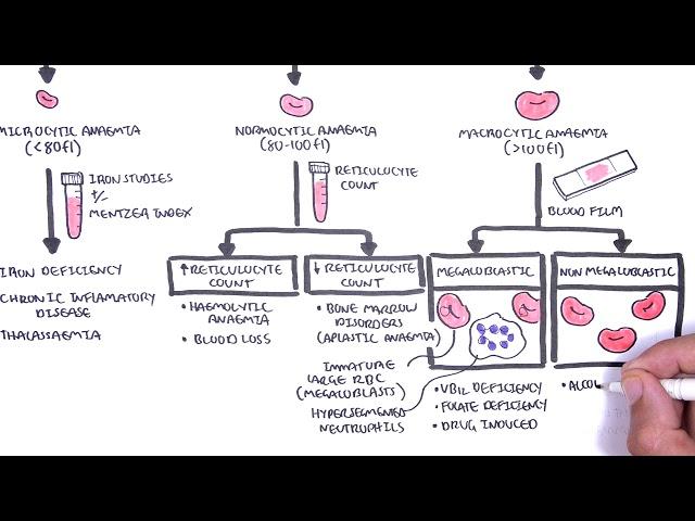 Anaemia (anemia) - classification (microcytic, normocytic and macrocytic) and pathophysiology