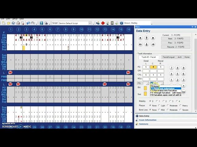 Charting Furcations and Mobility in Dentrix