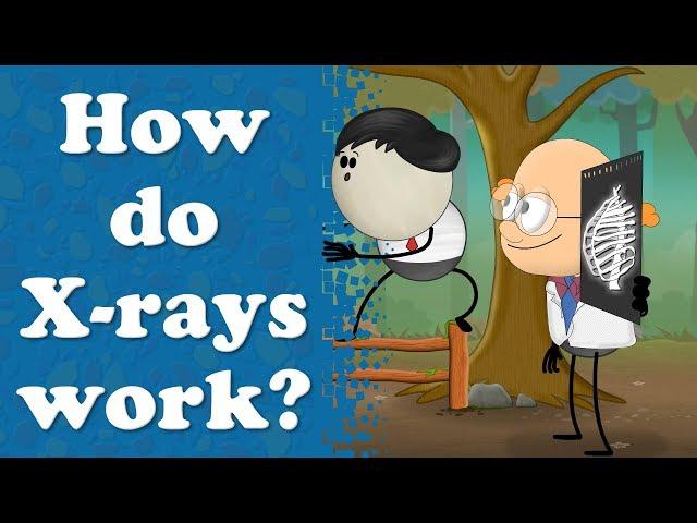 How do X-rays work? | #aumsum #kids #science #education #children