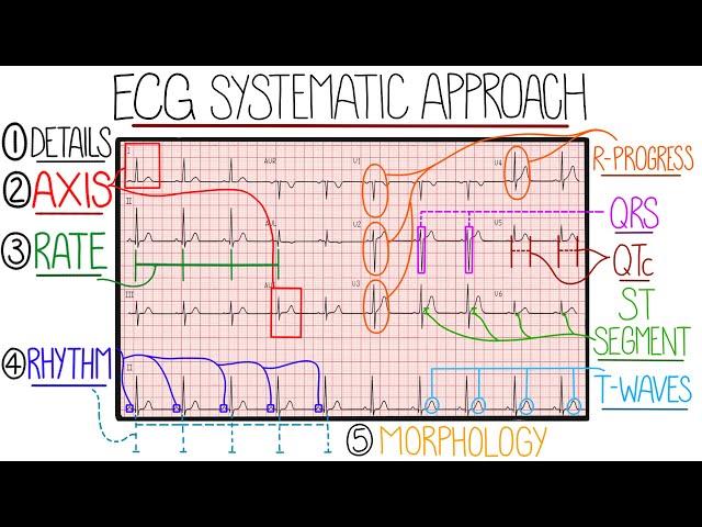 ECG Interpretation Made Easy (Learn How to Interpret an ECG in 13 Minutes)