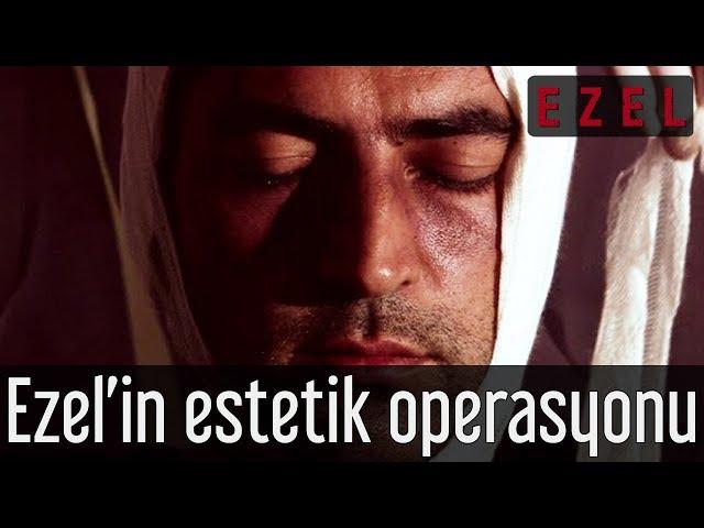 Ezel 3.Bölüm | Ramiz Dayı, Ezel'e estetik operasyon yaptırır