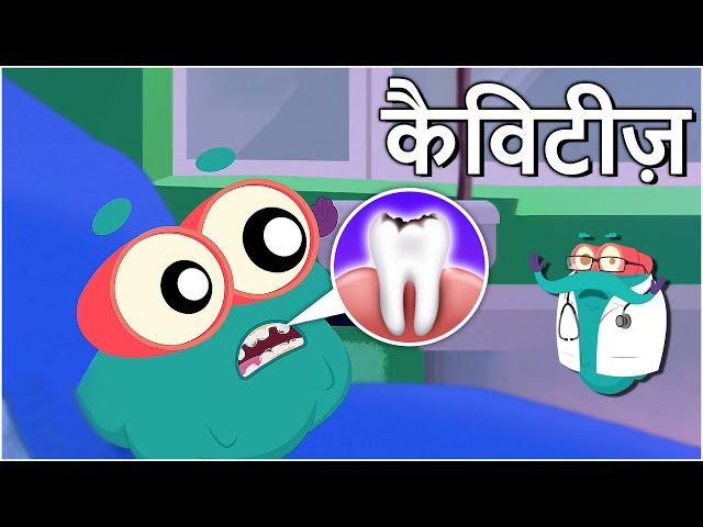 कैविटीज़ | दांतों में कीड़े | Cavities In Hindi | Dr.Binocs Show | Educational Videos For Kids