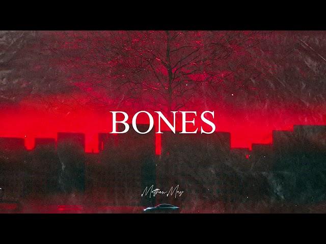 FREE FOR PROFIT - Selena Gomez ft Taylor Swift Smooth Dark Pop Type Beat - Bones