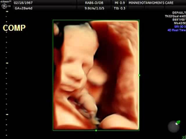 4D Ultrasound Video of Baby Before Birth