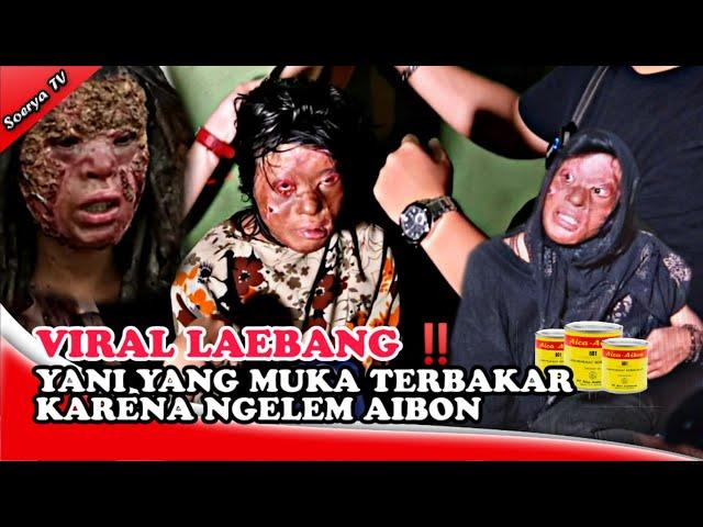 VIRAL LAEBANG ‼️ YANI YANG MUKA TERBAKAR KARENA NGELEM AIBON FT EGO ADRIANO DAN AYLA AYLU TV