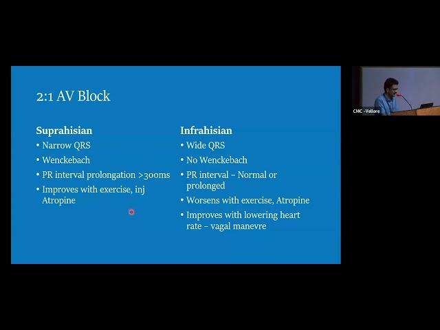 ARRYTHMIA IN CLINICAL MEDICINE - DR. ANAND M -  CARDIOLOGY