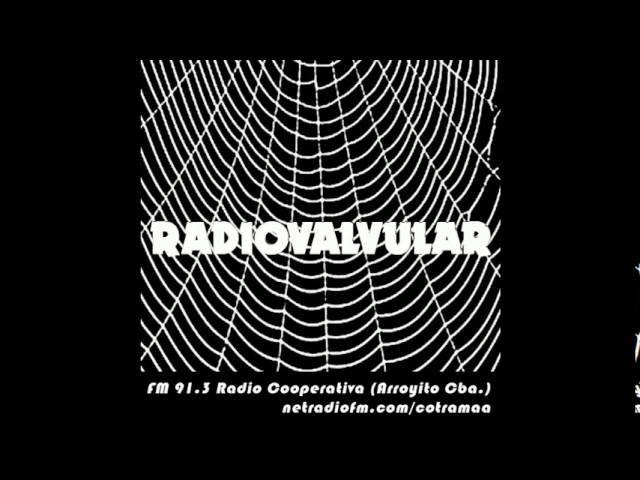 RadioValvular - resumen 20 agosto 2016 - Bloque de noticias