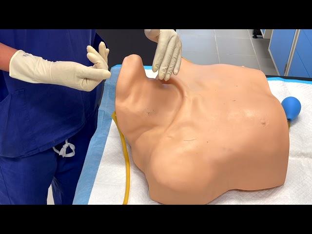 Central Venous Line (CVL) Insertion Using Anatomical Landmark Made Easy For OSCE