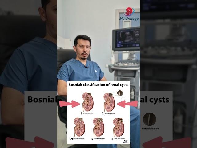 Buyrak kistasi aniqlanganda qilinadigan 3 ta qadam! @my_urology