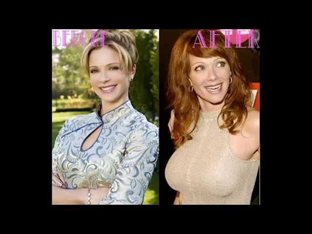 lauren holly plastic surgery