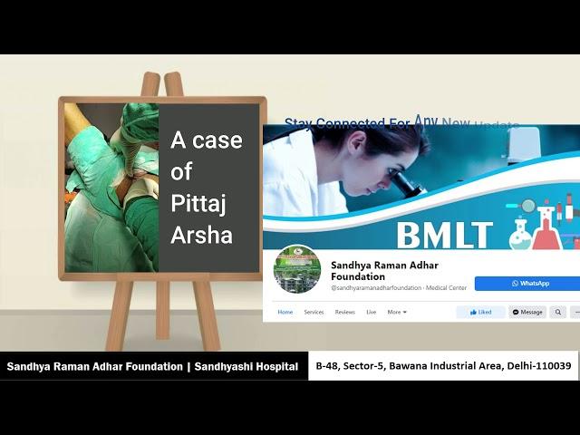 A case of Pittaj Arsha - By Dr. Vikas Gupta