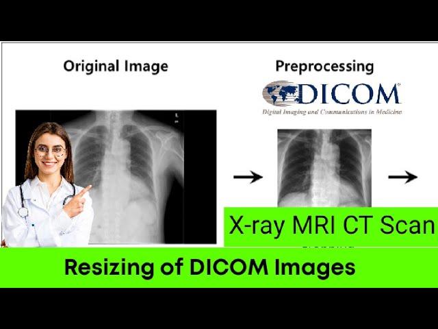 How to resize the DICOM images | Preprocessing | Processing |X ray MRI CT Scan |  ITFO