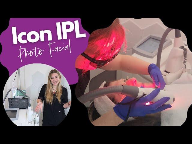 Revolutionize Your Skin with Icon IPL  - Laser Skin Revitalization