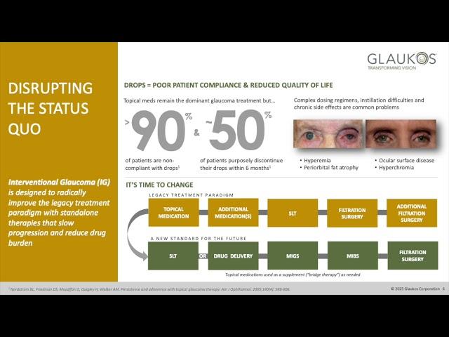 Glaukos Corporation (GKOS) Q4 2024 Earnings Call & Full Presentation