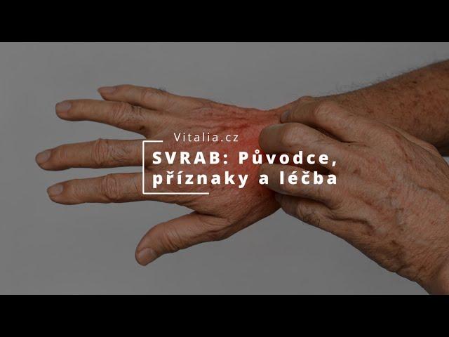 SVRAB (SCABIES): Původce, příznaky a léčba