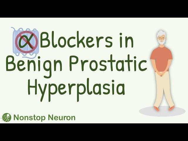 How Alpha Blockers Help in Benign Prostatic Hyperplasia?