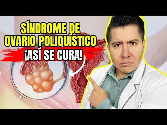 ¿Por qué TENGO SÍNDROME de OVARIO POLIQUÍSTICO? | Mr Doctor