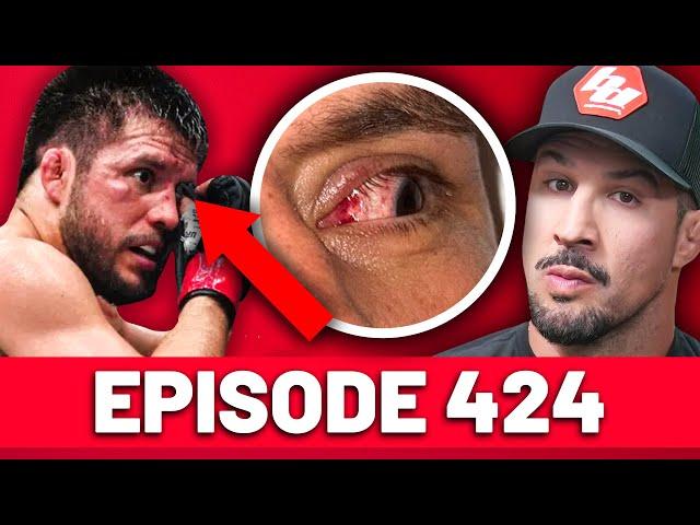 Henry Cejudo Looking for an out? Y'Stupid | Episode 424