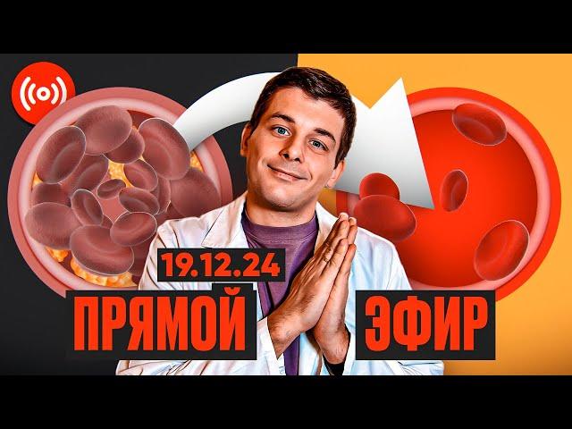 Препараты разжижающие кровь. Прямой эфир. #50