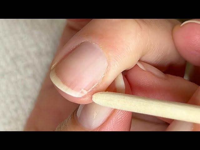 How to fix a cracked natural nail. [Pro Nail Technician explains]