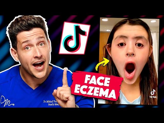 Shocking Medical Conditions On TikTok