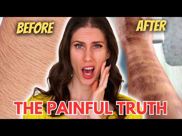 Home Laser Hair Removal Is A Lie - What Nobody Else Will Tell You (IPL Hair Removal)