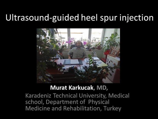 Ultrasound-guided heel spur injection, by Prof Murat Karkucak MD